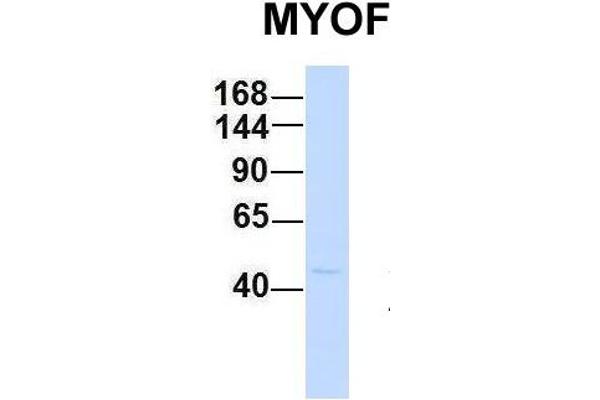 Myoferlin anticorps  (C-Term)