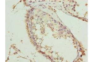Immunohistochemistry of paraffin-embedded human testis tissue using ABIN7173492 at dilution of 1:100 (TRMT6 antibody  (Catalytic Subunit))