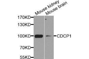 Western blot analysis of extract of mouse kidney and mouse brain cells, using CDCP1 antibody. (CDCP1 antibody)
