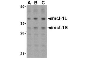 Image no. 1 for anti-Induced Myeloid Leukemia Cell Differentiation Protein Mcl-1 (MCL1) (Internal Region) antibody (ABIN207776) (MCL-1 antibody  (Internal Region))