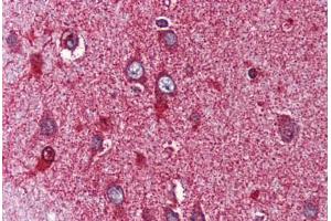 Anti-NR4A3 antibody  ABIN1049141 IHC staining of human brain, cortex. (NR4A3 antibody  (Internal Region))