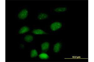 Immunofluorescence of purified MaxPab antibody to ZNF157 on HeLa cell. (ZNF157 antibody  (AA 1-506))