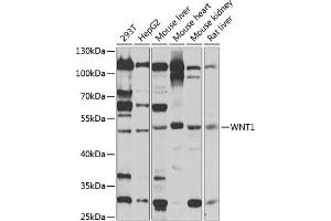 Western blot analysis of extracts of various cell lines, using WNT1 antibody (ABIN1683291, ABIN3016105, ABIN3016107 and ABIN6219551) at 1:1000 dilution. (WNT1 antibody  (AA 231-370))