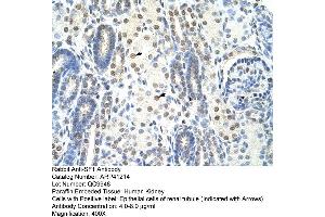 Rabbit Anti-SF1 Antibody  Paraffin Embedded Tissue: Human Kidney Cellular Data: Epithelial cells of renal tubule Antibody Concentration: 4. (Splicing Factor 1 antibody  (N-Term))