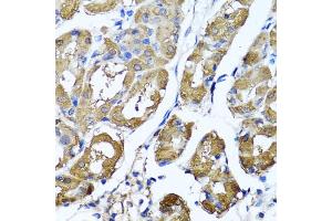 Immunohistochemistry of paraffin-embedded human stomach using HYAL1 antibody (ABIN5975045) at dilution of 1/100 (40x lens). (HYAL1 antibody)