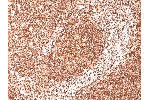 Immunohistochemistry (IHC) image for anti-Protein tyrosine Phosphatase, Receptor Type, C (PTPRC) antibody (FITC) (ABIN6935201)