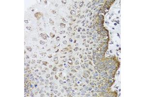 Immunohistochemistry of paraffin-embedded human esophagus using FANCL antibody (ABIN5995461) at dilution of 1/100 (40x lens). (FANCL antibody)