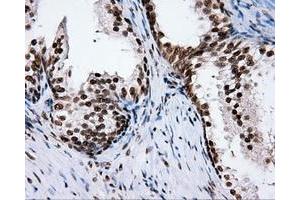 Immunohistochemical staining of paraffin-embedded Kidney tissue using anti-RC204952 mouse monoclonal antibody. (XRCC1 antibody)