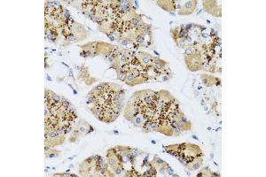 Immunohistochemistry of paraffin-embedded human stomach using CHIC2 antibody (ABIN6130103, ABIN6138533, ABIN6138534 and ABIN6223980) at dilution of 1:100 (40x lens). (CHIC2 antibody  (AA 1-165))
