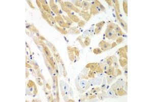 Immunohistochemistry of paraffin-embedded mouse heart using PCBP2 antibody (ABIN5971362) at dilution of 1/100 (40x lens). (PCBP2 antibody)