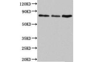 Western Blot Positive WB detected in: Jurkat whole cell lysate, Rat lung tissue, Mouse liver tissue All lanes: SUN2 antibody at 4. (SUN2 antibody  (AA 45-155))