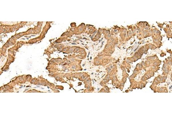 RPS25 antibody