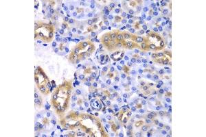 Immunohistochemistry of paraffin-embedded mouse kidney using SYNCRIP antibody. (SYNCRIP antibody  (AA 1-200))