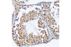 Immunohistochemistry of paraffin-embedded mouse testis using W/W/W Rabbit mAb (ABIN7271346) at dilution of 1:100 (40x lens). (WASF2 antibody)