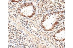 Immunohistochemistry of paraffin-embedded Human appendix using MCM5 Polyclonal Antibody at dilution of 1:100 (40x lens). (MCM5 antibody)