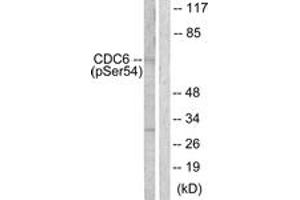 Western blot analysis of extracts from COS7 cells treated with EGF 200ng/ml 30', using CDC6 (Phospho-Ser54) Antibody. (CDC6 antibody  (pSer54))