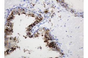 Image no. 3 for anti-Sex Determining Region Y (SRY) antibody (ABIN1501140)