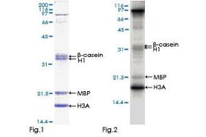 Kinase Activity Assay (KAA) image for Mitogen-Activated Protein Kinase-Activated Protein Kinase 5 (MAPKAPK5) (AA 1-471) protein (GST tag) (ABIN1310330) (MAPKAP Kinase 5 Protein (AA 1-471) (GST tag))
