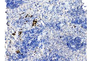 PD1 was detected in paraffin-embedded sections of rat spleen tissues using rabbit anti- PD1 Antigen Affinity purified polyclonal antibody (Catalog # ) at 1 µg/mL. (PD-1 antibody  (N-Term))