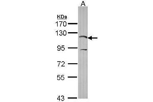 WB Image Sample (30 ug of whole cell lysate) A: HCT116 7. (PIK3CA antibody  (N-Term))