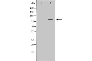 Western blot analysis of extracts of HeLa, using ZYX antibody. (ZYX antibody  (Internal Region))