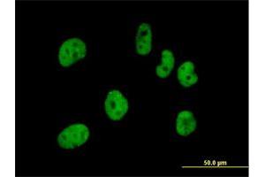 Immunofluorescence of purified MaxPab antibody to FLJ12529 on HeLa cell.