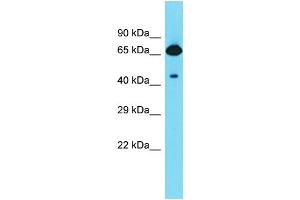 Host: Rabbit  Target Name: Frmd6  Sample Tissue: Rat Stomach lysates  Antibody Dilution: 1. (FRMD6 antibody  (C-Term))