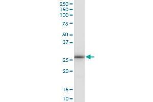 Immunoprecipitation of LRRK1 transfected lysate using anti-LRRK1 MaxPab rabbit polyclonal antibody and Protein A Magnetic Bead , and immunoblotted with LRRK1 purified MaxPab mouse polyclonal antibody (B01P) . (LRRK1 antibody  (AA 1-261))