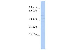 WNT2 antibody used at 1 ug/ml to detect target protein. (WNT2 antibody  (Middle Region))
