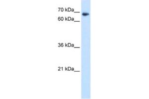 Western Blotting (WB) image for anti-TAF6 RNA Polymerase II, TATA Box Binding Protein (TBP)-Associated Factor, 80kDa (TAF6) antibody (ABIN2461025) (TAF6 antibody)