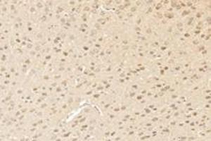 Immunohistochemistry analysis of paraffin-embedded mouse striatum using,RHOBTB3 (ABIN7075422) at dilution of 1: 3600 (RHOBTB3 antibody)
