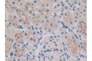 Detection of 15-LO-2 in Rat Kidney Tissue using Polyclonal Antibody to 15-Lipoxygenase-2 (15-LO-2) (ALOX15B antibody  (AA 349-633))