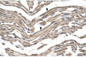 Human Muscle (C1QB antibody  (C-Term))