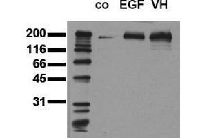 Western Blotting (WB) image for anti-Epidermal Growth Factor Receptor (EGFR) (pTyr1173) antibody (ABIN126779)