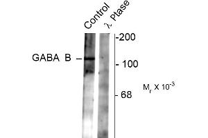 Western blots of rat synaptic membrane showing specific immunolabeling of the ~102 k GABAB R2 protein phosphorylated at Ser783 (control). (GABBR2 antibody  (pSer783))