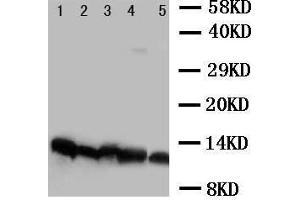 Anti-NDUFA1 antibody, Western blotting Lane 1: Rat Cardiac Muscle Tissue Lysate Lane 2: Rat Liver Tissue Lysate Lane 3: Rat Kidney Tissue Lysate Lane 4: Rat Brain Tissue Lysate Lane 5:  Cell Lysate (NDUFA1 antibody  (C-Term))