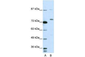 WB Suggested Anti-EXOSC10 Antibody Titration:  5. (EXOSC10 antibody  (C-Term))