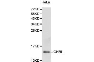 Western Blotting (WB) image for anti-Ghrelin (GHRL) (AA 1-117) antibody (ABIN3021901) (Ghrelin antibody  (AA 1-117))