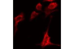 ABIN6279082 staining HeLa cells by IF/ICC. (ADAMTS1 antibody  (Internal Region))