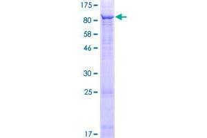Tetratricopeptide Repeat Domain 6 (TTC6) (AA 1-600) protein (GST tag)