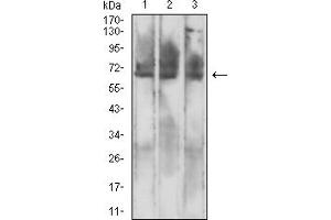 Western blot analysis using MSLN mouse mAb against CHO3D10 (1), SK-MES-1 (2), and HL-60 (3) cell lysate.