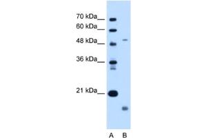 Western Blotting (WB) image for anti-Zinc Metalloproteinase, Ste24 (Zmpste24) antibody (ABIN2462996)