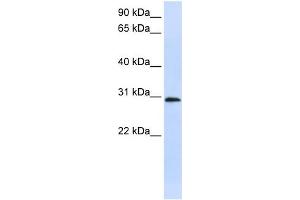 WB Suggested Anti-C6orf21 Antibody Titration:  0. (LY6G6F antibody  (Middle Region))