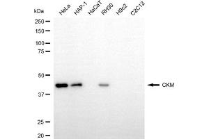 Western blotting analysis using CKM antibody (ABIN7798164).