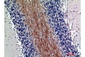Immunohistochemical analysis of paraffin-embedded human-brain, antibody was diluted at 1:200 (SIRPA/SIRPB1 (Internal Region) antibody)