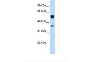 Image no. 1 for anti-Argininosuccinate Lyase (ASL) (AA 101-150) antibody (ABIN6737993) (ASL antibody  (AA 101-150))