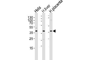 Western blot analysis of lysates from Hela cell line , human liver and placenta tissue lysate(from left to right), using OLR1 Antibody at 1:1000 at each lane. (OLR1 antibody  (AA 64-92))