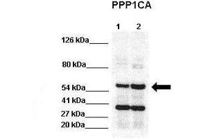 WB Suggested Anti-PPP1CA Antibody  Positive Control: Lane 1:441 µg HEK293 lysate Lane 2: 041 µg H1299 lysate Primary Antibody Dilution: 1:0000Secondary Antibody: Goat anti-rabbit-HRP Secondry  Antibody Dilution: 1:0000Submitted by: Jose Luis Rosa, Universitat de Barcelona (PPP1CA antibody  (N-Term))