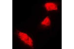 Immunofluorescent analysis of Cytokeratin 18 staining in A431 cells. (Cytokeratin 18 antibody  (C-Term))