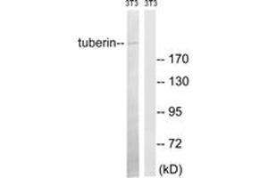 Western blot analysis of extracts from NIH-3T3 cells, using Tuberin (Ab-981) Antibody.